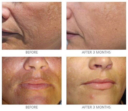 iS Clinical Brightening Complex 30g