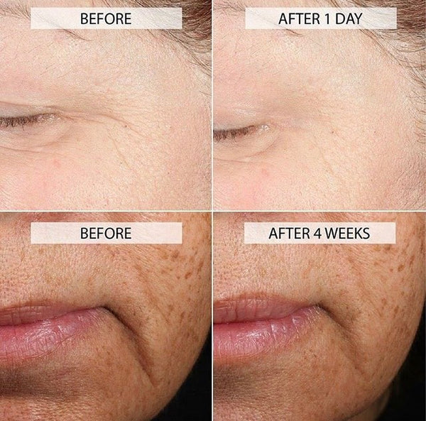 iS Clinical Brightening Complex 30g
