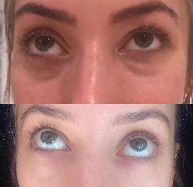 iS Clinical C Eye Serum Advance+ 15ml