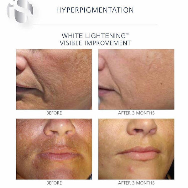 iS Clinical Brightening Serum 15ml