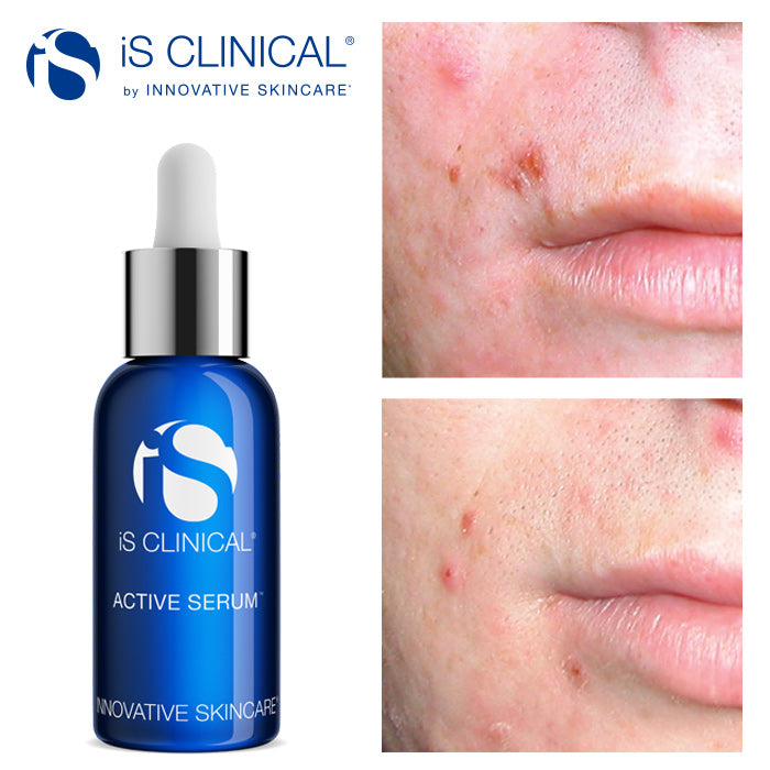 iS Clinical Active Serum 15ml