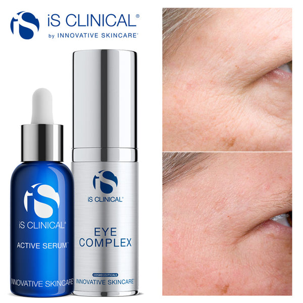 iS Clinical Active Serum 15ml