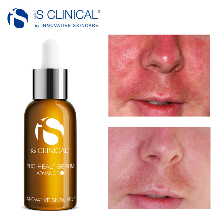 iS Clinical Pro-Heal Serum Advance+ 15ml